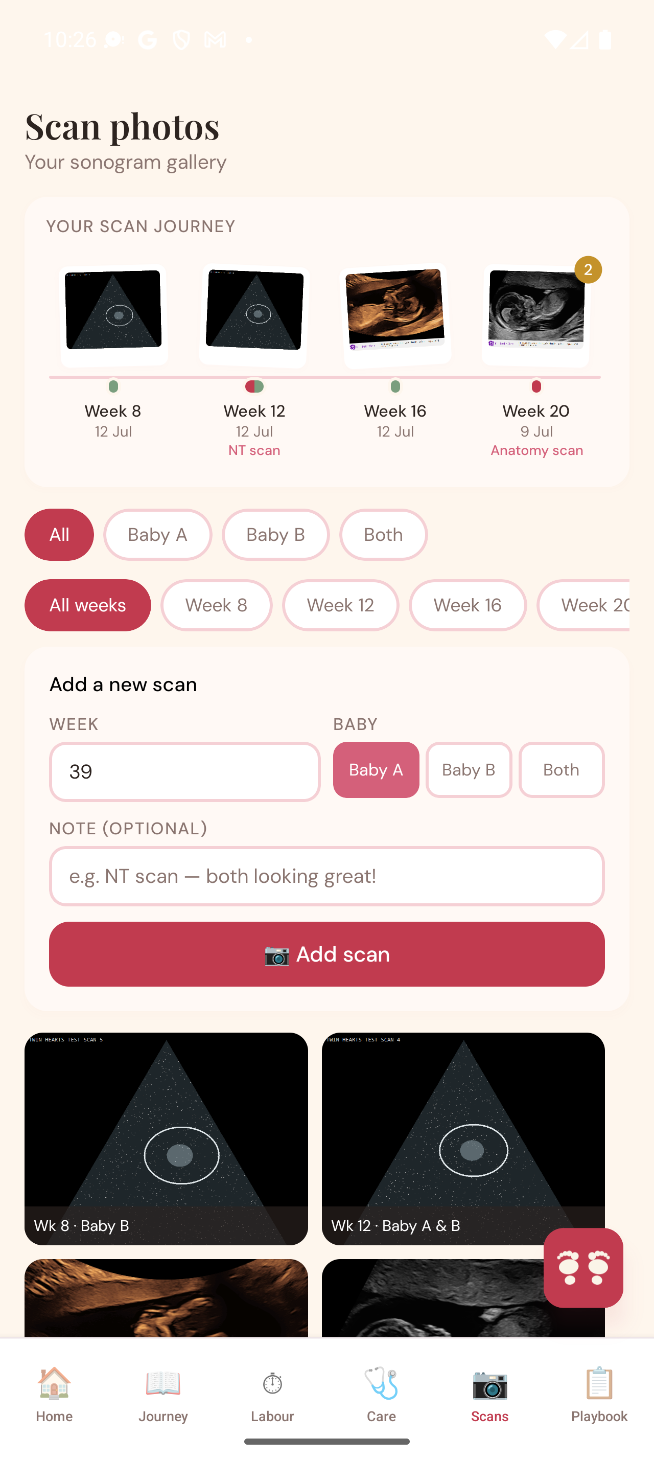 Twin Hearts scan gallery showing scan photos organised along a week-by-week timeline